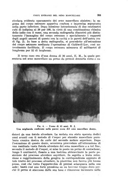 Il Valsalva rivista mensile di oto-rino-laringojatria