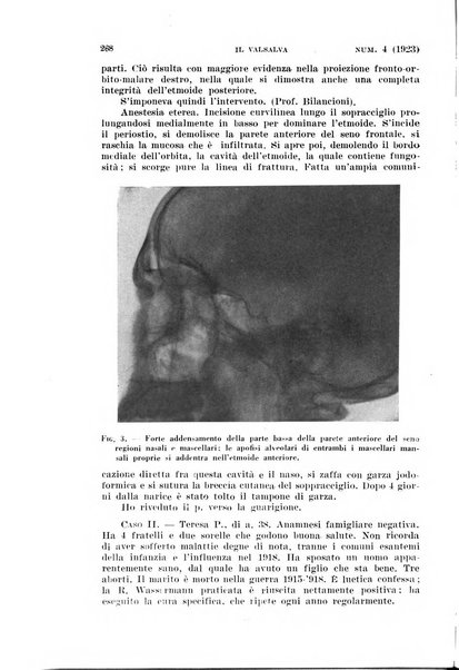 Il Valsalva rivista mensile di oto-rino-laringojatria