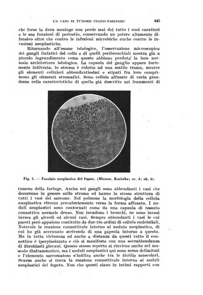 Il Valsalva rivista mensile di oto-rino-laringojatria