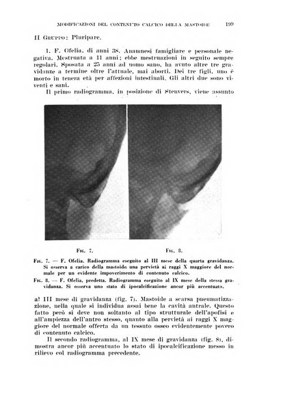 Il Valsalva rivista mensile di oto-rino-laringojatria