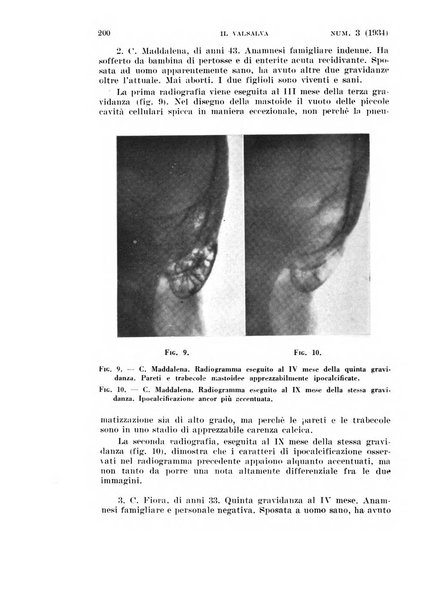 Il Valsalva rivista mensile di oto-rino-laringojatria