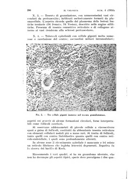 Il Valsalva rivista mensile di oto-rino-laringojatria