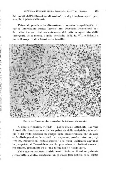 Il Valsalva rivista mensile di oto-rino-laringojatria