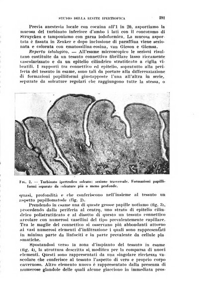 Il Valsalva rivista mensile di oto-rino-laringojatria