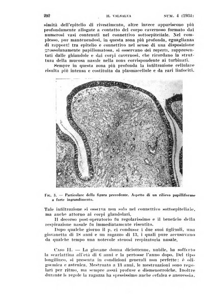 Il Valsalva rivista mensile di oto-rino-laringojatria