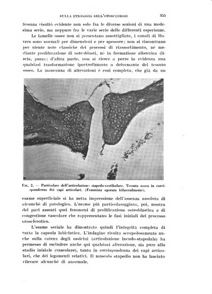 Il Valsalva rivista mensile di oto-rino-laringojatria