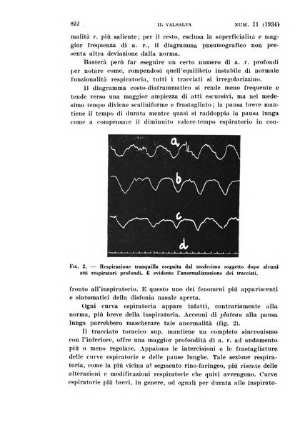 Il Valsalva rivista mensile di oto-rino-laringojatria