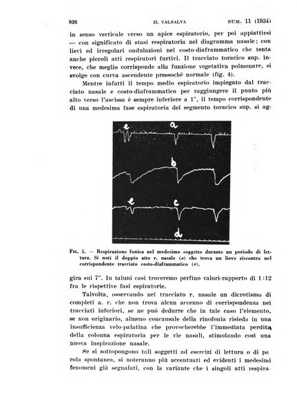 Il Valsalva rivista mensile di oto-rino-laringojatria