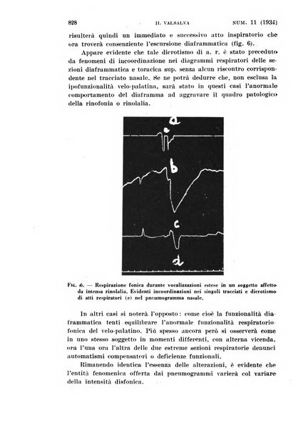 Il Valsalva rivista mensile di oto-rino-laringojatria