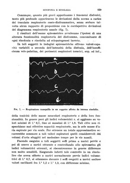 Il Valsalva rivista mensile di oto-rino-laringojatria