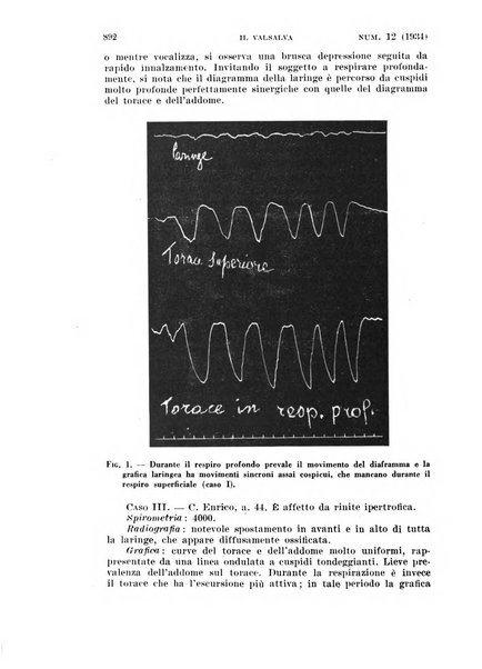 Il Valsalva rivista mensile di oto-rino-laringojatria