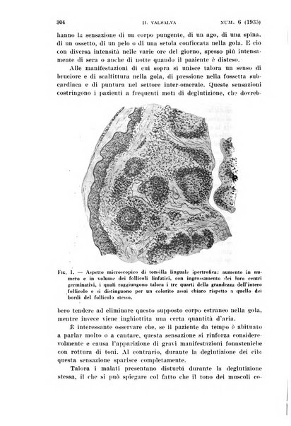 Il Valsalva rivista mensile di oto-rino-laringojatria