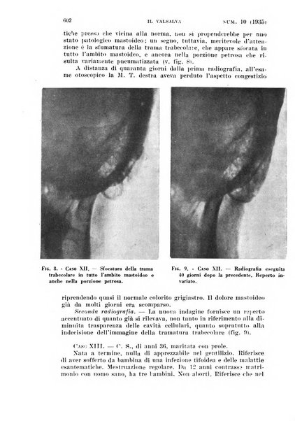 Il Valsalva rivista mensile di oto-rino-laringojatria