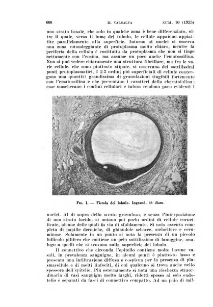 Il Valsalva rivista mensile di oto-rino-laringojatria