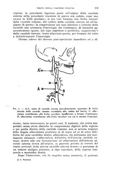 Il Valsalva rivista mensile di oto-rino-laringojatria