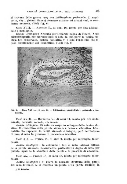 Il Valsalva rivista mensile di oto-rino-laringojatria