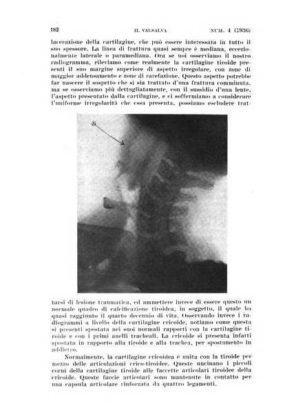 Il Valsalva rivista mensile di oto-rino-laringojatria