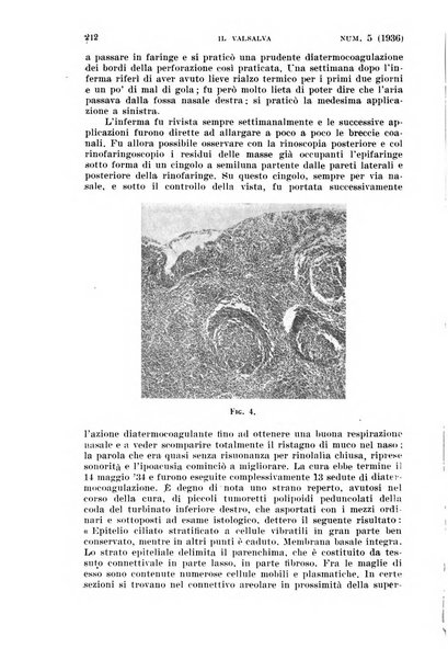 Il Valsalva rivista mensile di oto-rino-laringojatria