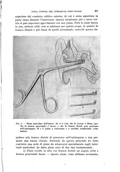 Il Valsalva rivista mensile di oto-rino-laringojatria