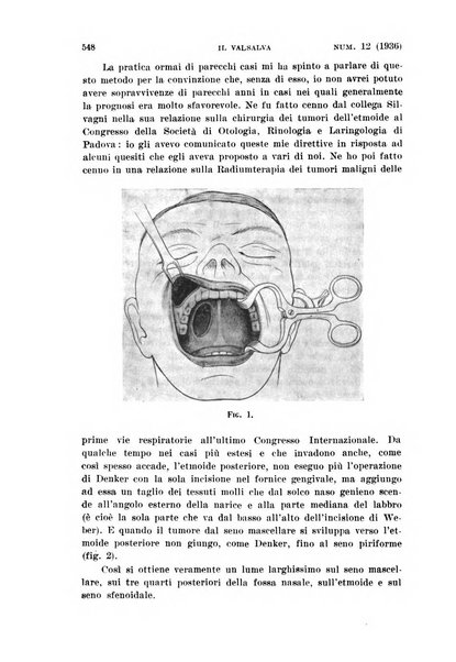 Il Valsalva rivista mensile di oto-rino-laringojatria