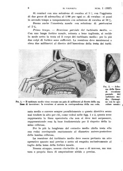 Il Valsalva rivista mensile di oto-rino-laringojatria