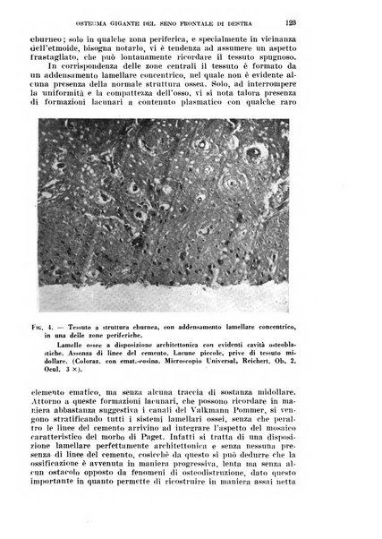 Il Valsalva rivista mensile di oto-rino-laringojatria