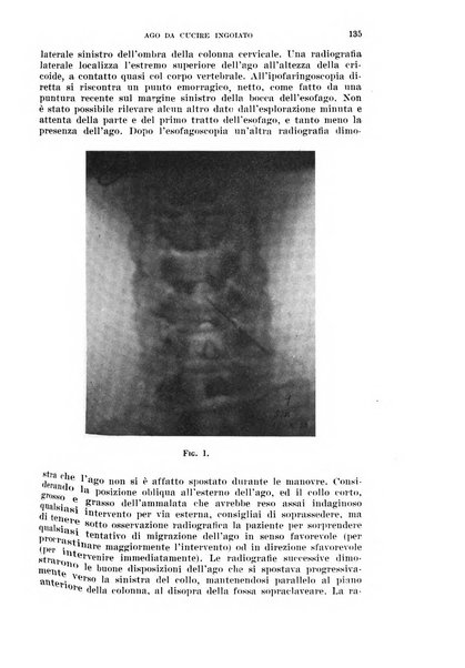 Il Valsalva rivista mensile di oto-rino-laringojatria