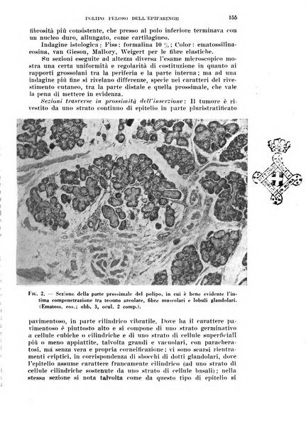 Il Valsalva rivista mensile di oto-rino-laringojatria