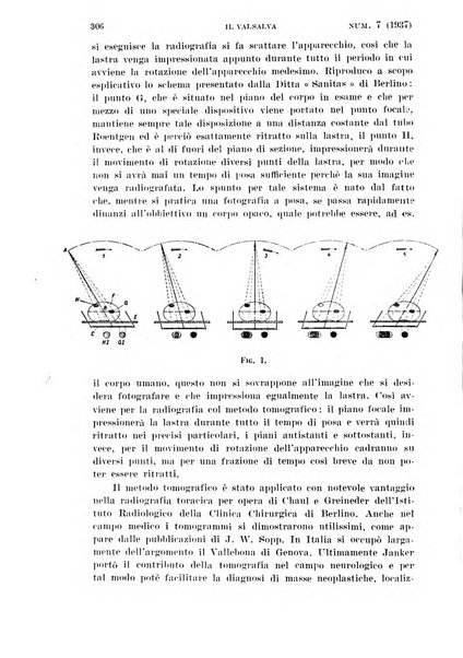 Il Valsalva rivista mensile di oto-rino-laringojatria