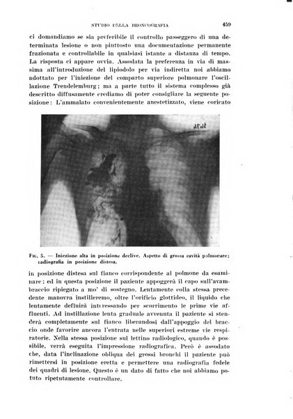 Il Valsalva rivista mensile di oto-rino-laringojatria