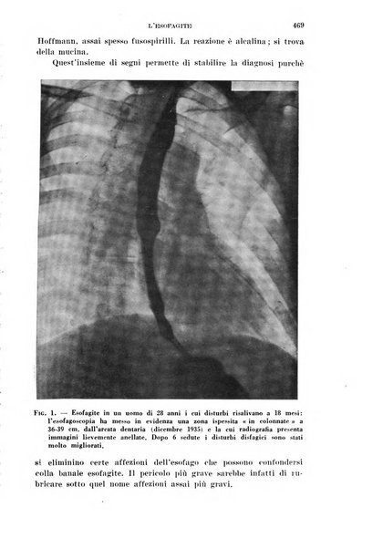 Il Valsalva rivista mensile di oto-rino-laringojatria