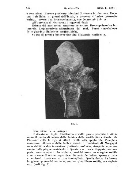 Il Valsalva rivista mensile di oto-rino-laringojatria