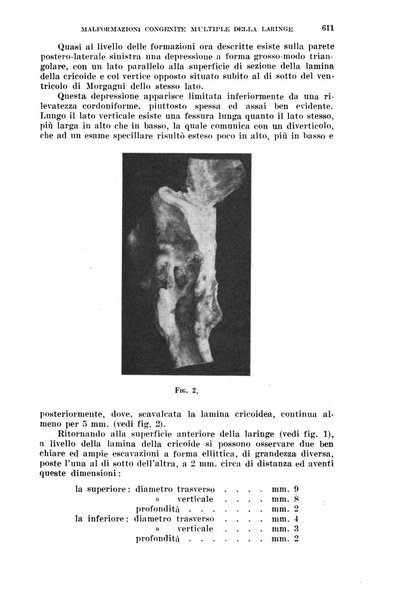 Il Valsalva rivista mensile di oto-rino-laringojatria