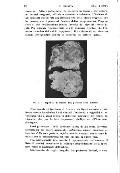 Il Valsalva rivista mensile di oto-rino-laringojatria