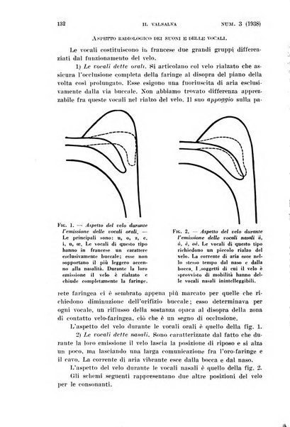 Il Valsalva rivista mensile di oto-rino-laringojatria