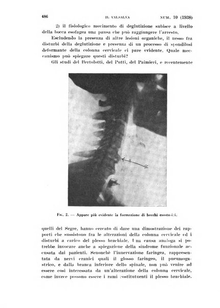 Il Valsalva rivista mensile di oto-rino-laringojatria