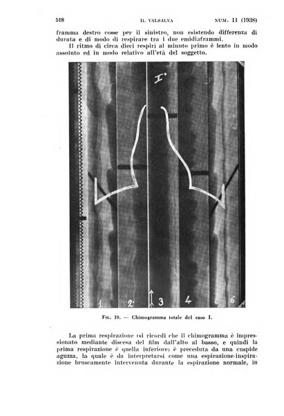 Il Valsalva rivista mensile di oto-rino-laringojatria