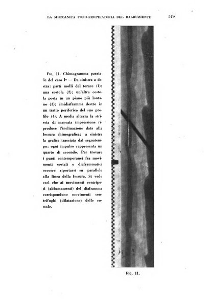 Il Valsalva rivista mensile di oto-rino-laringojatria