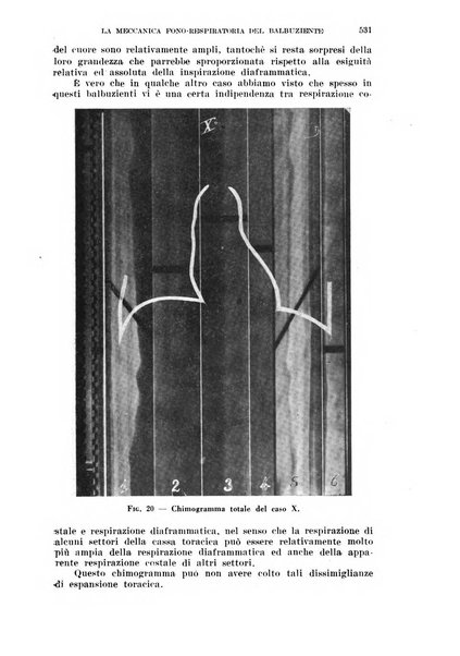 Il Valsalva rivista mensile di oto-rino-laringojatria