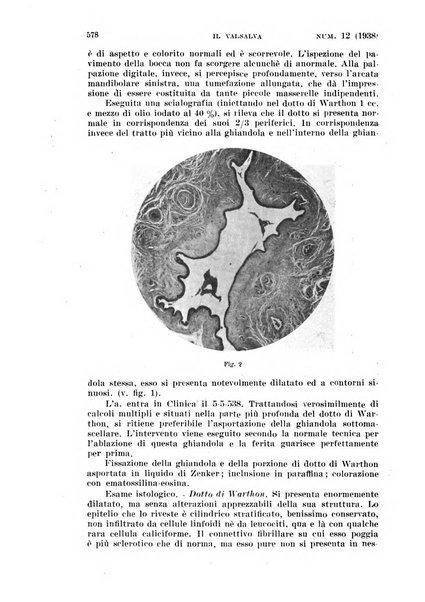 Il Valsalva rivista mensile di oto-rino-laringojatria