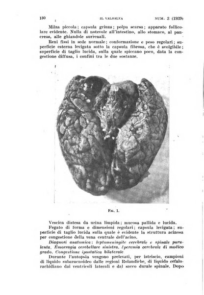 Il Valsalva rivista mensile di oto-rino-laringojatria