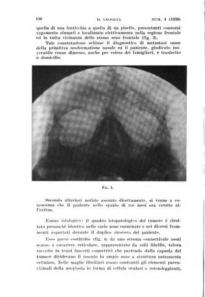 Il Valsalva rivista mensile di oto-rino-laringojatria