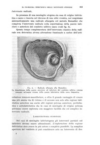 Il Valsalva rivista mensile di oto-rino-laringojatria