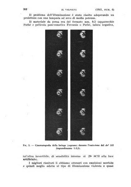 Il Valsalva rivista mensile di oto-rino-laringojatria