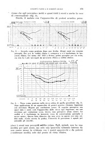 Il Valsalva rivista mensile di oto-rino-laringojatria