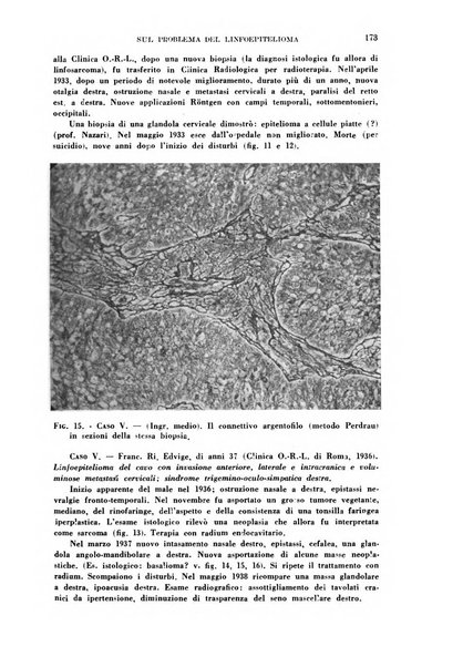 Il Valsalva rivista mensile di oto-rino-laringojatria