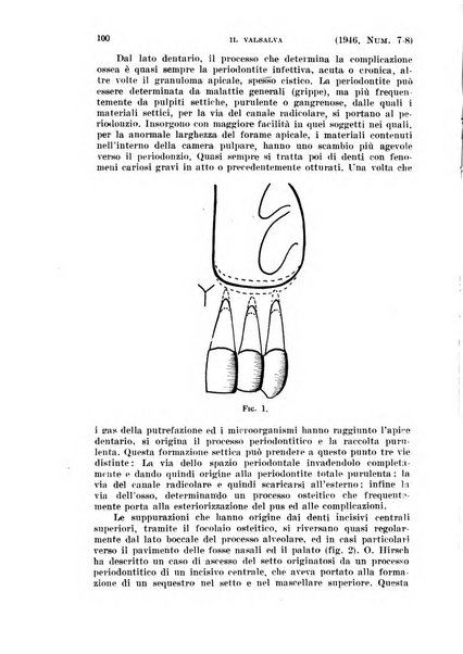 Il Valsalva rivista mensile di oto-rino-laringojatria