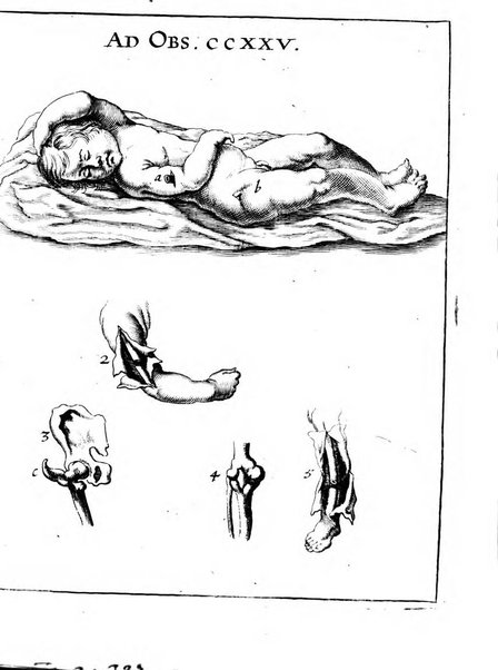 Miscellanea curiosa medico-physica Academiae naturae curiosorum sive ephemeridum medico-physicarum Germanicarum..