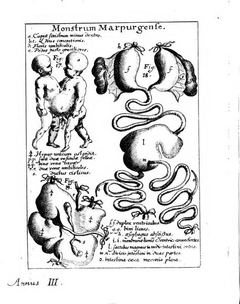 Miscellanea curiosa medico-physica Academiae naturae curiosorum sive ephemeridum medico-physicarum Germanicarum..