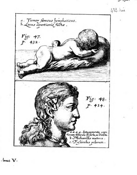 Miscellanea curiosa medico-physica Academiae naturae curiosorum sive ephemeridum medico-physicarum Germanicarum..